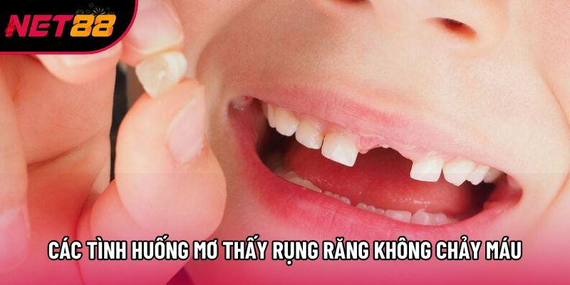 Các tình huống mơ thấy rụng răng không chảy máu hay gặp